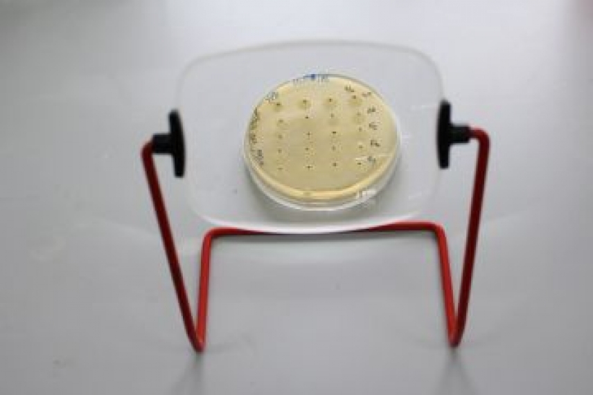 Prueban la inusual eficacia del principal antioxidante de las células, clave en enfermedades neurodegenerativas y cáncer